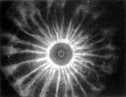 Looking down the barrel of plasma focus